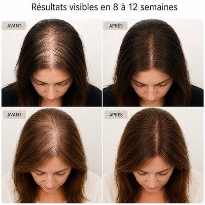 Vélora™ Casquette Densité Capillaire